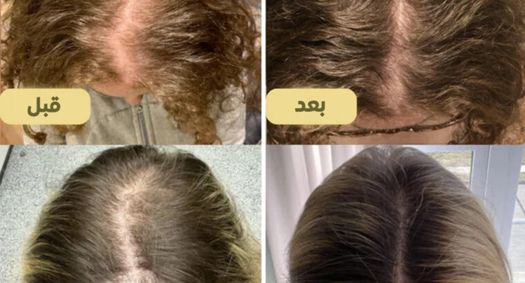 نمو الشعر قوي وطويل مع زيت نمو الشعر Veganic……