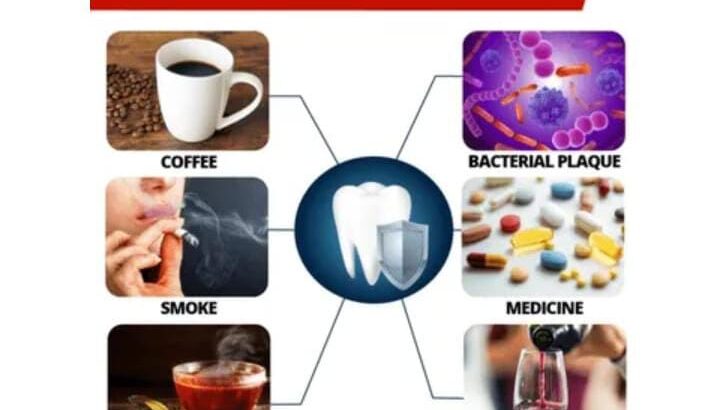 معجون الأسنان المبيض لإزالة البقع بالامارات ممتاز.