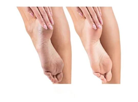 Flawless Pedi Vac جهاز باديكير تصميم عصرى ومريح