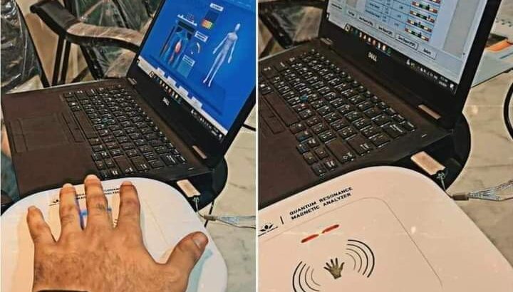 جهاز التحليل باستخدام تقنية الرنين المغناطيسي جيد
